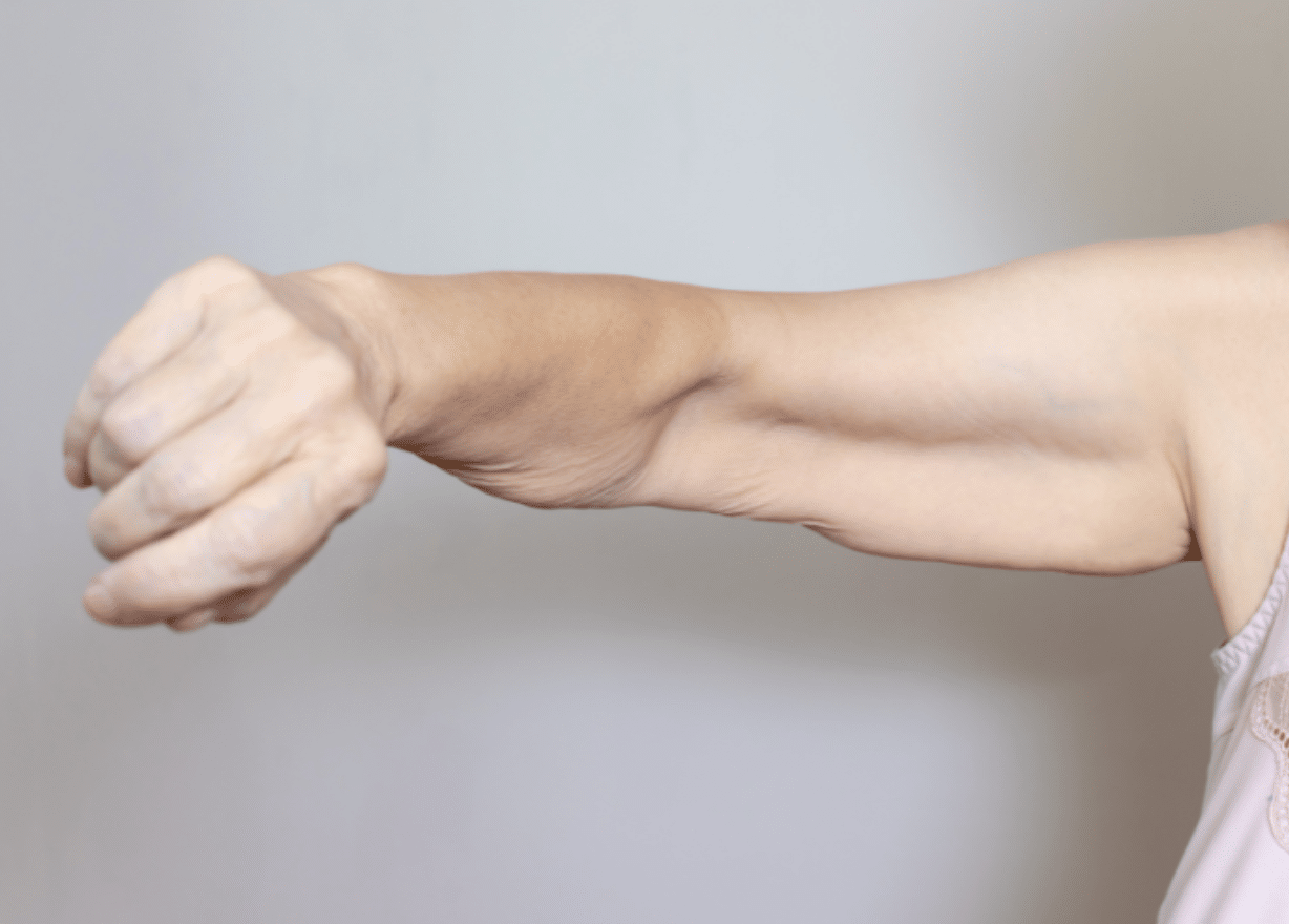 GLP 1 muscle loss